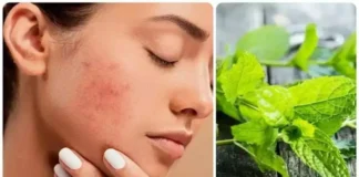 घर में पुदीने के पत्तों का ऐसे करें इस्तेमाल, गायब हो जाएंगे पिंपल्स और एक्ने, जाने कैसे – 24×7 Khabre Fatafat घर में पुदीने के पत्तों का ऐसे करें इस्तेमाल, गायब हो जाएंगे पिंपल्स और एक्ने, जाने कैसे - 24x7 India News